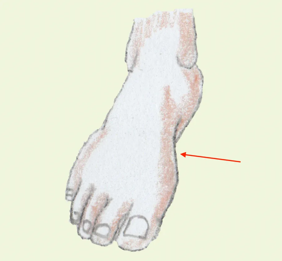 tʰalka