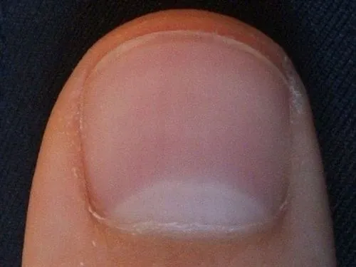 Ich'ak