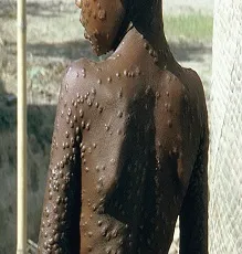 ama poṭatu
