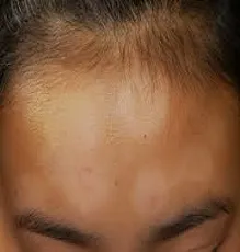 neytti
