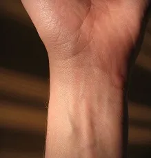 kai tappe