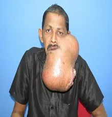kaṭṭi