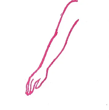 കൈ