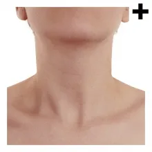 kunka
