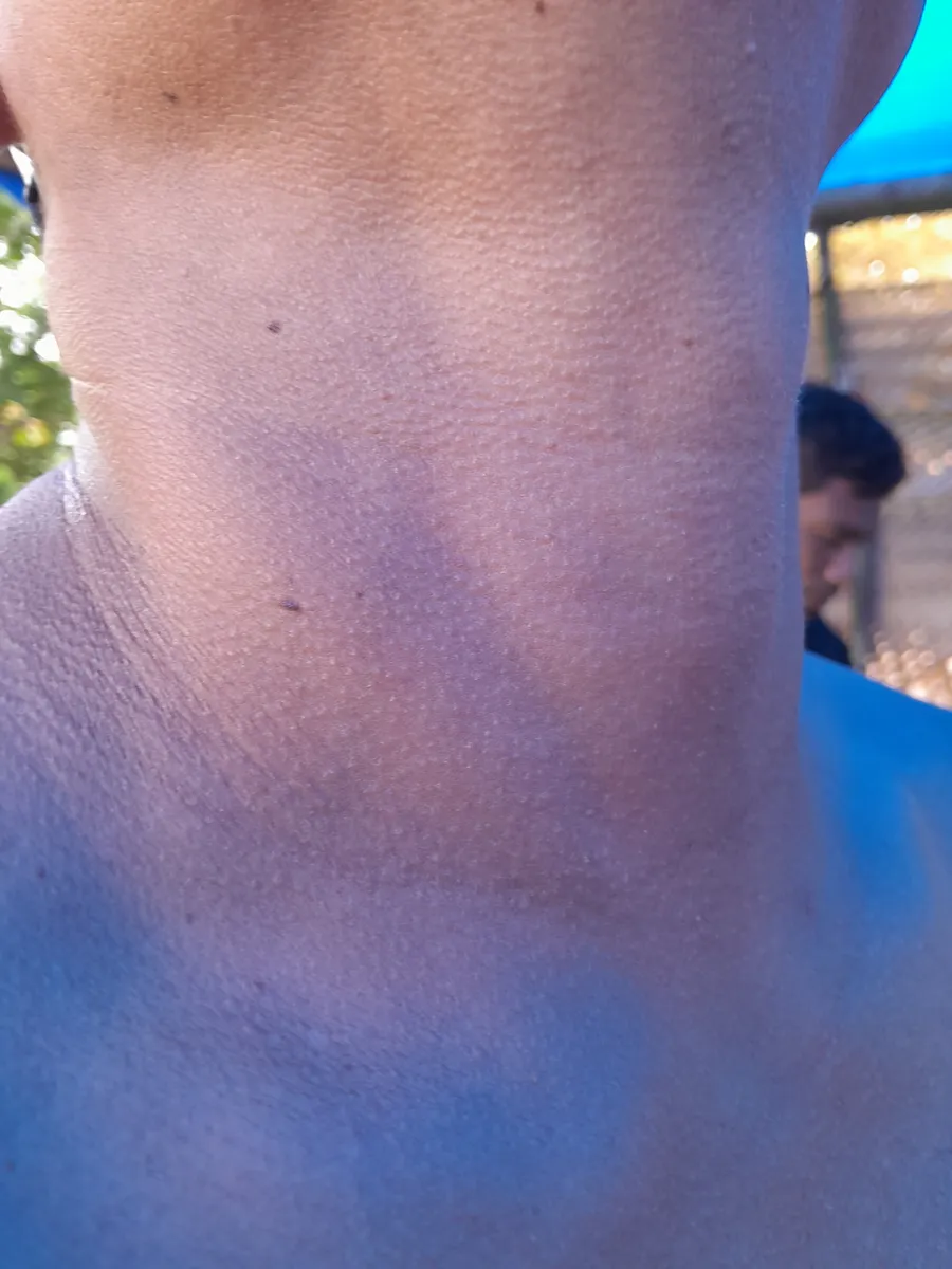 otxeto