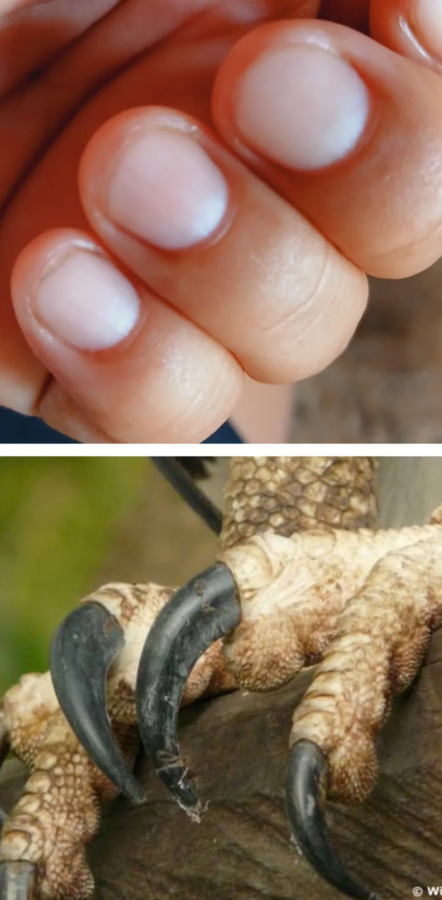 amotxkito