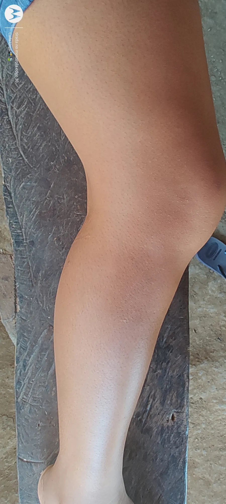 yotxito